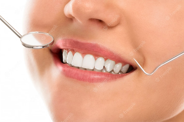 Smile designing-1