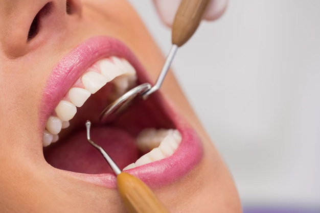 Smile designing-2